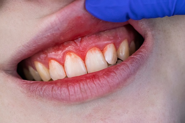 What Is Periodontics?